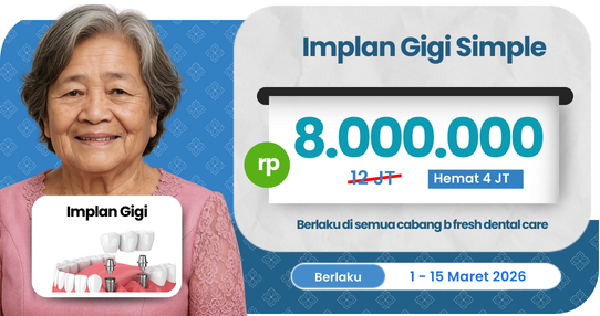 Implan Gigi Simple